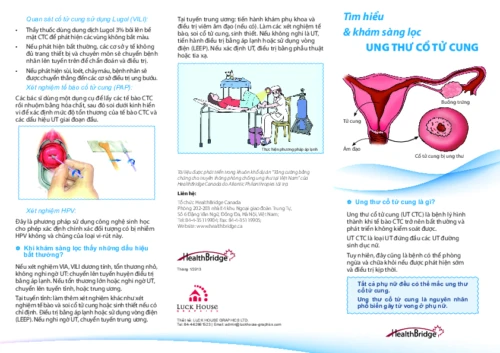 Tìm hiểu & phát hiện sớm ung cổ tử cung